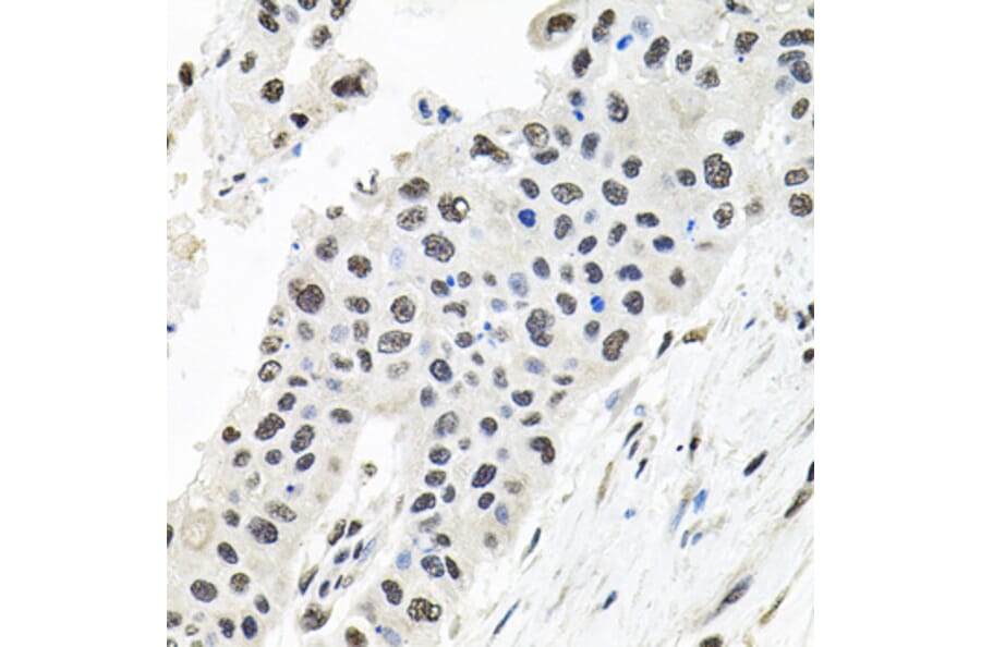 Immunohistochemistry - Anti-Borealin/CDCA8 Antibody (A89455) - Antibodies.com