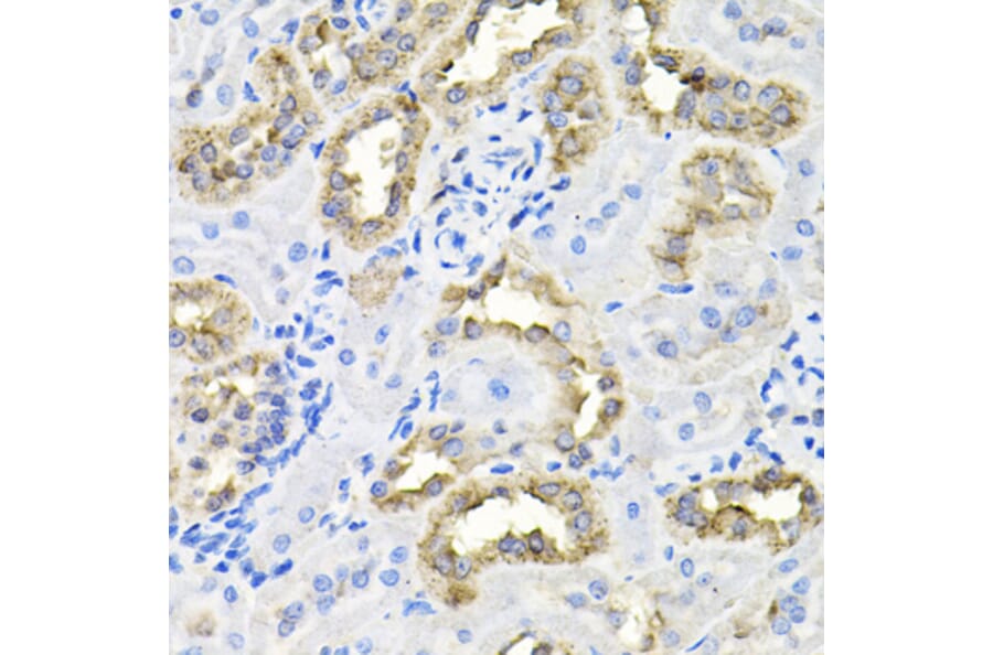 Immunohistochemistry - Anti-Borealin/CDCA8 Antibody (A89455) - Antibodies.com
