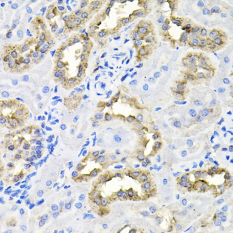 Immunohistochemistry - Anti-Borealin/CDCA8 Antibody (A89455) - Antibodies.com