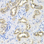 Immunohistochemistry - Anti-Borealin/CDCA8 Antibody (A89455) - Antibodies.com