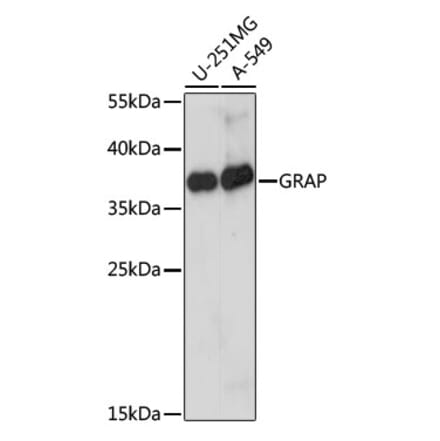 Western Blot - Anti-GRAP Antibody (A89456) - Antibodies.com