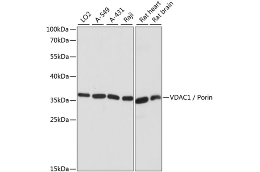 Western Blot - Anti-VDAC1/Porin Antibody (A89457) - Antibodies.com
