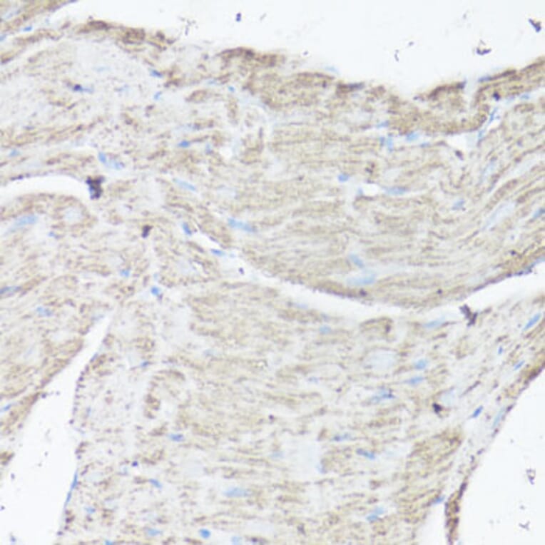Immunohistochemistry - Anti-VDAC1/Porin Antibody (A89457) - Antibodies.com