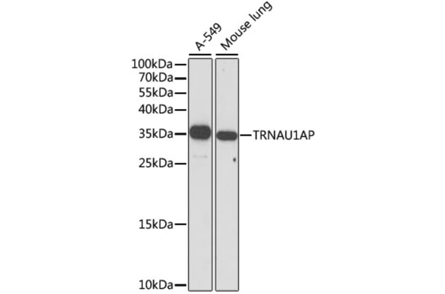 Western Blot - Anti-TRNAU1AP Antibody (A89458) - Antibodies.com