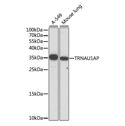 Western Blot - Anti-TRNAU1AP Antibody (A89458) - Antibodies.com