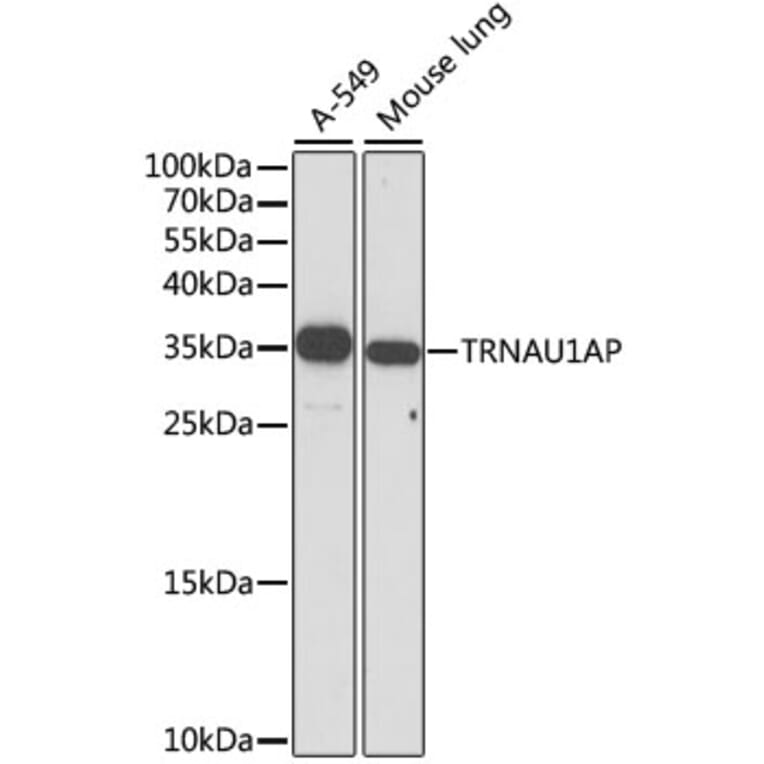 Western Blot - Anti-TRNAU1AP Antibody (A89458) - Antibodies.com