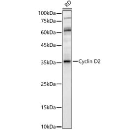 Western Blot - Anti-Cyclin D2 Antibody (A89459) - Antibodies.com