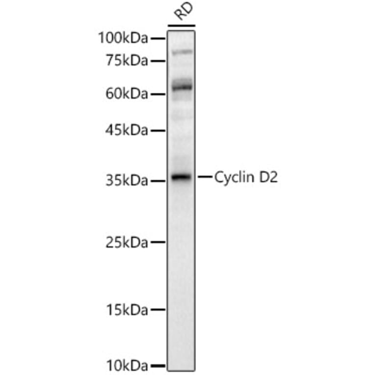 Western Blot - Anti-Cyclin D2 Antibody (A89459) - Antibodies.com