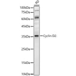 Western Blot - Anti-Cyclin D2 Antibody (A89459) - Antibodies.com