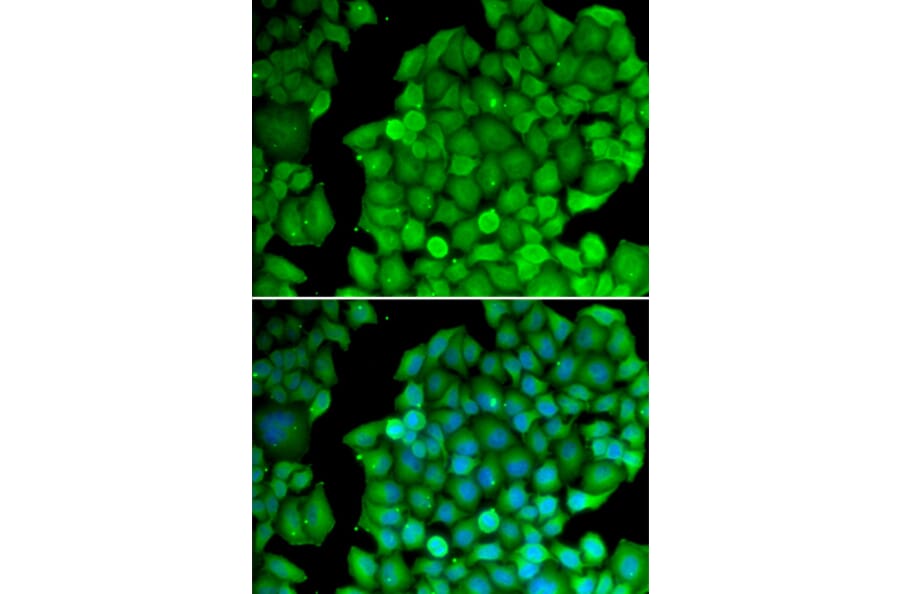 Immunofluorescence - Anti-Cyclin D2 Antibody (A89459) - Antibodies.com
