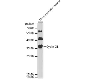 Western Blot - Anti-Cyclin G Antibody (A89461) - Antibodies.com