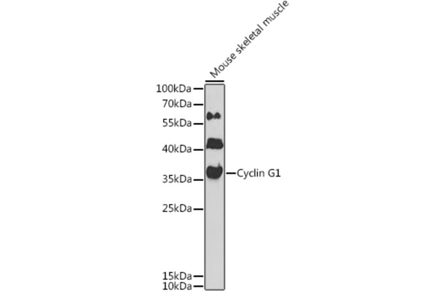 Western Blot - Anti-Cyclin G Antibody (A89461) - Antibodies.com