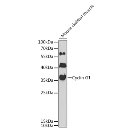 Western Blot - Anti-Cyclin G Antibody (A89461) - Antibodies.com