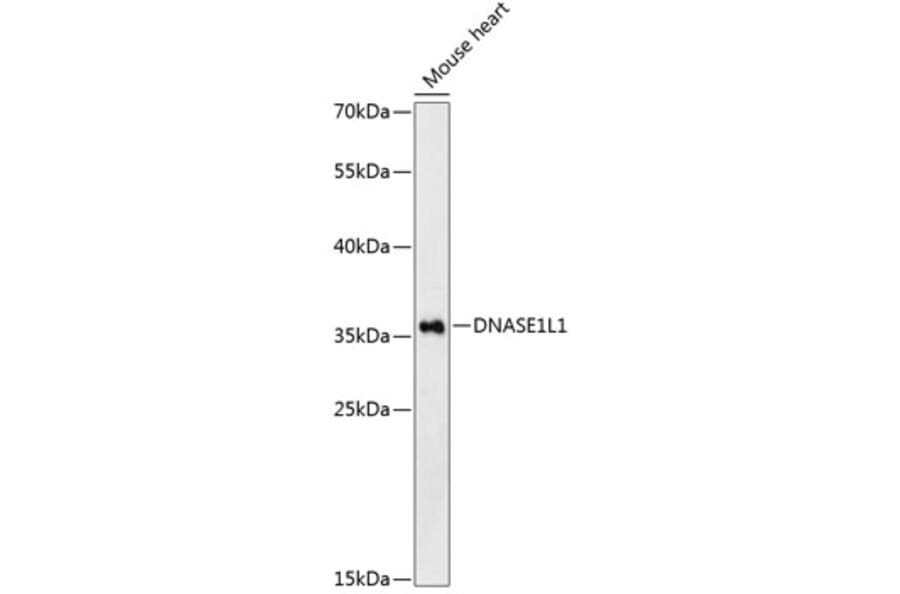 Western Blot - Anti-Deoxyribonuclease I like 1 Antibody (A89463) - Antibodies.com