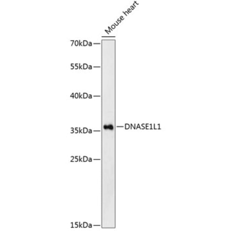 Western Blot - Anti-Deoxyribonuclease I like 1 Antibody (A89463) - Antibodies.com