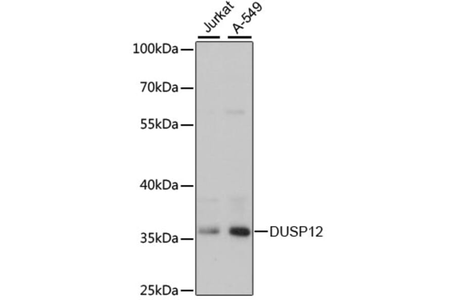 Western Blot - Anti-DUSP12 Antibody (A89464) - Antibodies.com