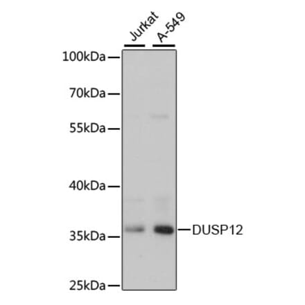 Western Blot - Anti-DUSP12 Antibody (A89464) - Antibodies.com