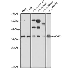 Western Blot - Anti-SKIC8 Antibody (A89465) - Antibodies.com