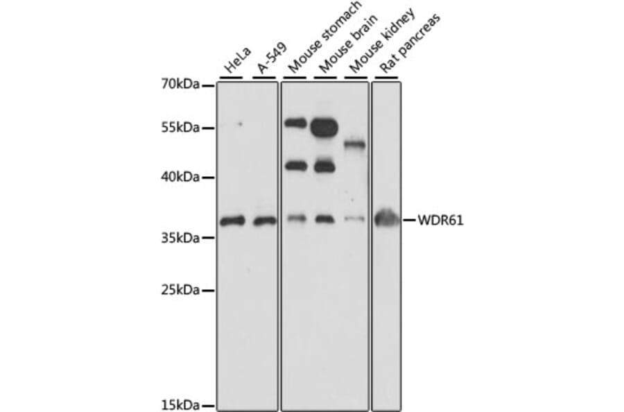Western Blot - Anti-SKIC8 Antibody (A89465) - Antibodies.com