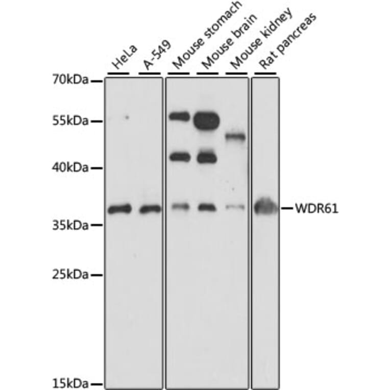 Western Blot - Anti-SKIC8 Antibody (A89465) - Antibodies.com