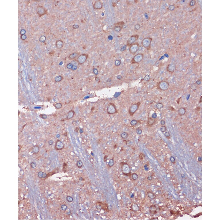 Immunohistochemistry - Anti-SKIC8 Antibody (A89465) - Antibodies.com