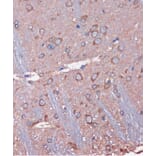 Immunohistochemistry - Anti-SKIC8 Antibody (A89465) - Antibodies.com