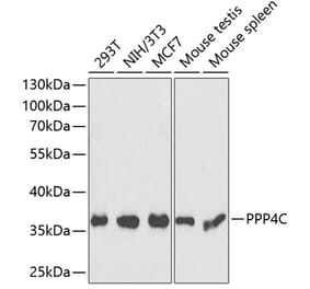 Western Blot - Anti-PP-X Antibody (A89466) - Antibodies.com
