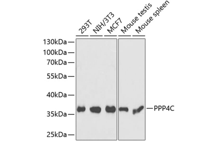 Western Blot - Anti-PP-X Antibody (A89466) - Antibodies.com