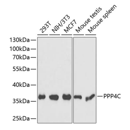 Western Blot - Anti-PP-X Antibody (A89466) - Antibodies.com