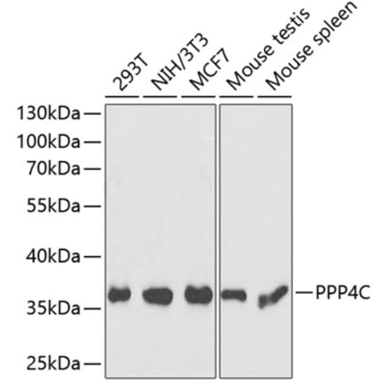 Western Blot - Anti-PP-X Antibody (A89466) - Antibodies.com