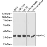 Western Blot - Anti-PP-X Antibody (A89466) - Antibodies.com