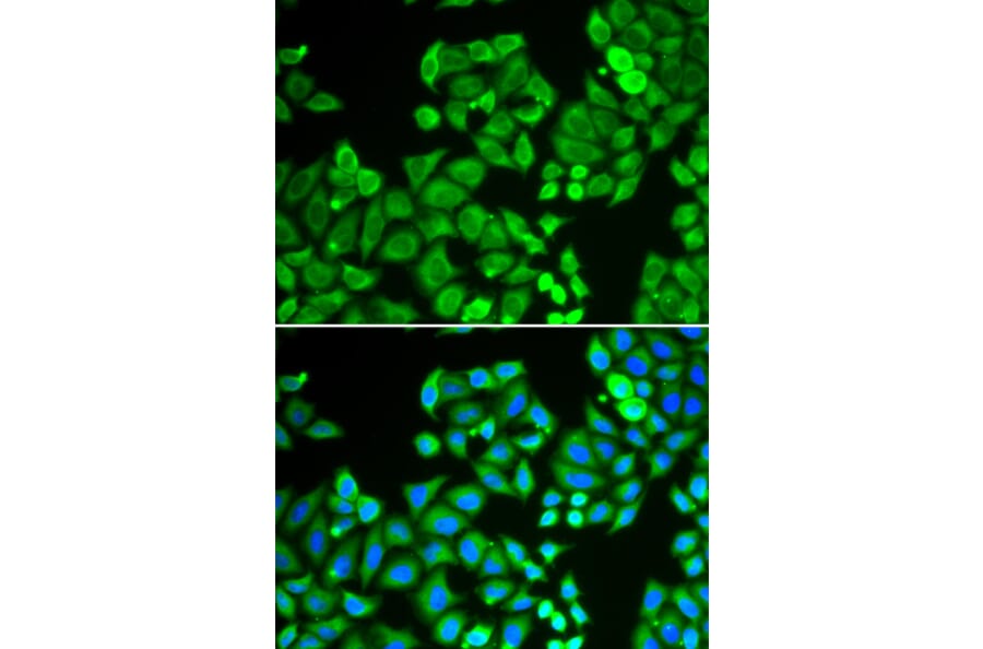 Immunofluorescence - Anti-PP-X Antibody (A89466) - Antibodies.com