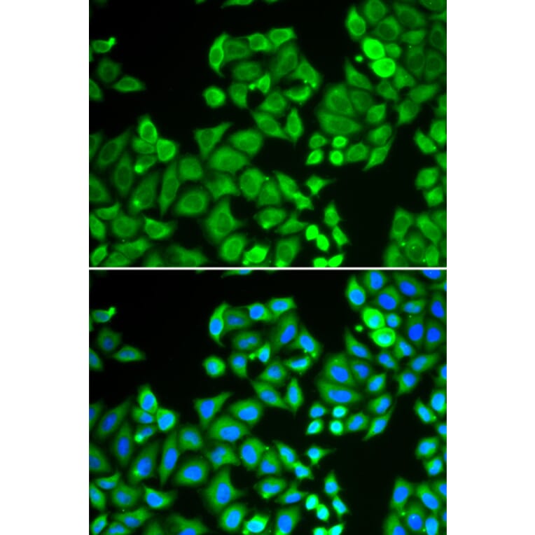 Immunofluorescence - Anti-PP-X Antibody (A89466) - Antibodies.com