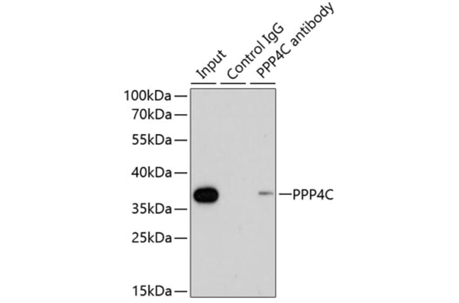 Western Blot - Anti-PP-X Antibody (A89466) - Antibodies.com
