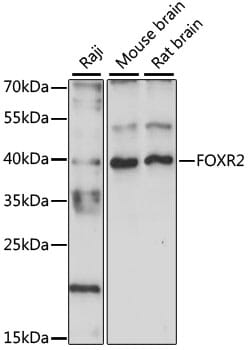 Western blot analysis of extracts of various cell lines, using Anti-FOXR2 Antibody (A15567) at 1:1,000 dilution.
Secondary antibody: Goat Anti-Rabbit IgG (H+L) (HRP) (AS014) at 1:10,000 dilution.
Lysates / proteins: 25µg per lane.
Blocking buffer: 3% non-fat dry milk in TBST.
Detection: ECL Basic Kit (RM00020).
Exposure time: 90s.