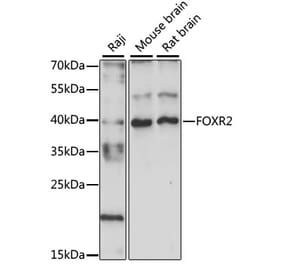 Western Blot - Anti-FOXR2 Antibody (A89468) - Antibodies.com