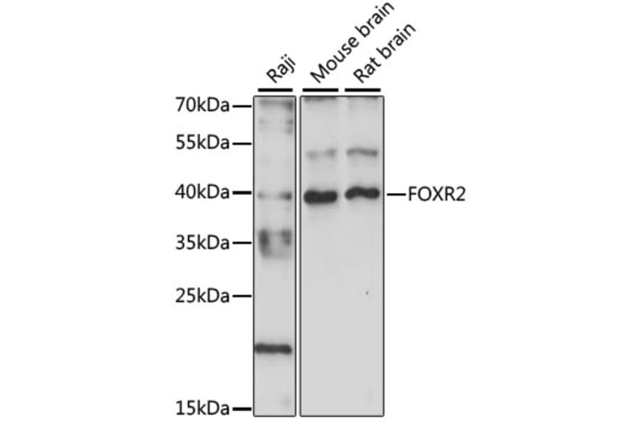 Western Blot - Anti-FOXR2 Antibody (A89468) - Antibodies.com