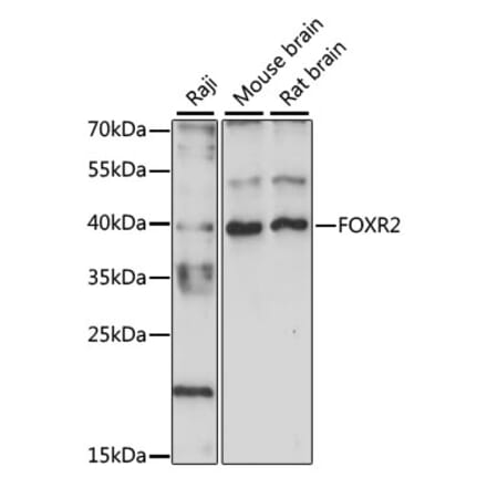 Western Blot - Anti-FOXR2 Antibody (A89468) - Antibodies.com