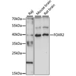 Western Blot - Anti-FOXR2 Antibody (A89468) - Antibodies.com