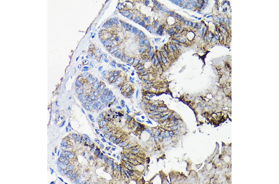 Immunohistochemistry - Anti-Annexin-13/ANXA13 Antibody (A89469) - Antibodies.com