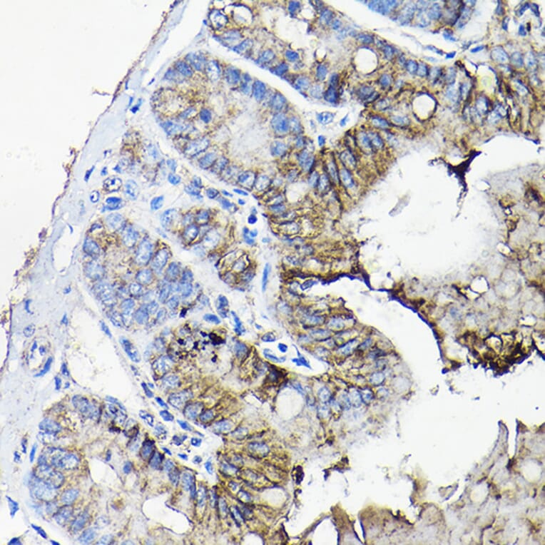 Immunohistochemistry - Anti-Annexin-13/ANXA13 Antibody (A89469) - Antibodies.com