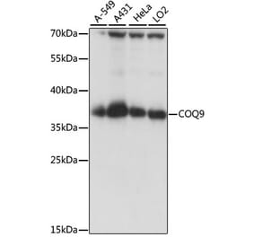 Western Blot - Anti-COQ9 Antibody (A89470) - Antibodies.com