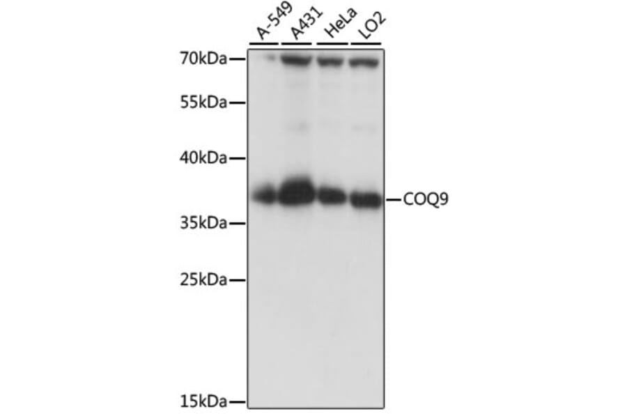 Western Blot - Anti-COQ9 Antibody (A89470) - Antibodies.com