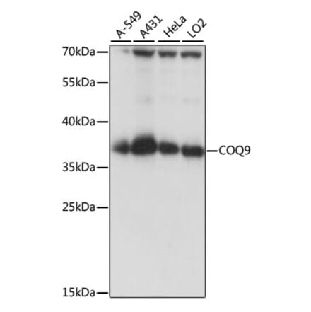 Western Blot - Anti-COQ9 Antibody (A89470) - Antibodies.com