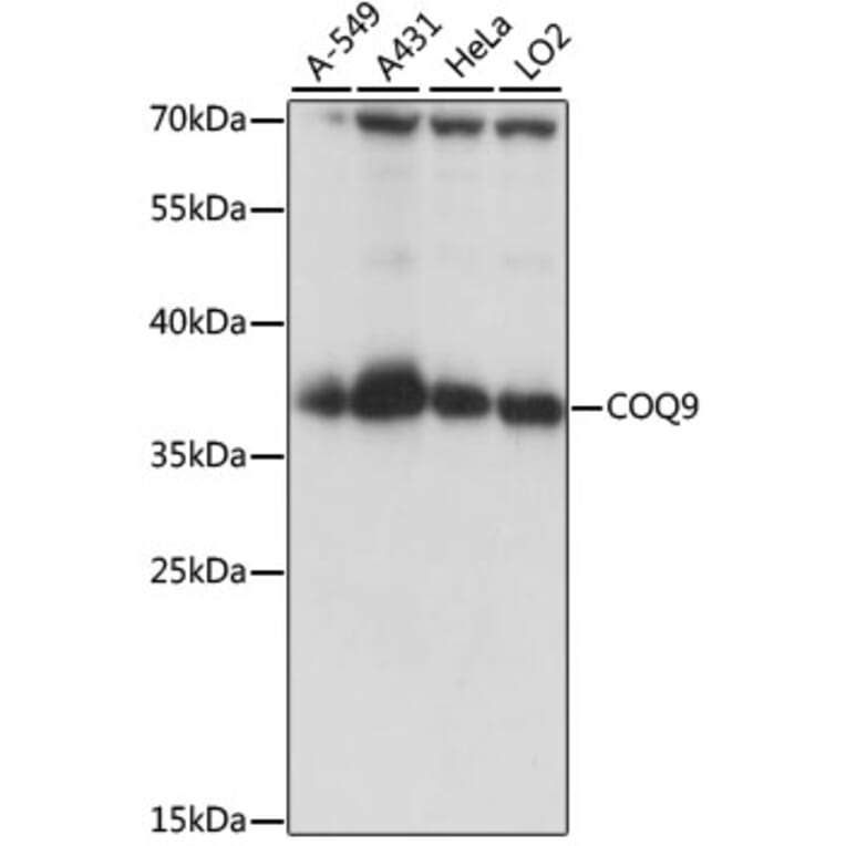 Western Blot - Anti-COQ9 Antibody (A89470) - Antibodies.com