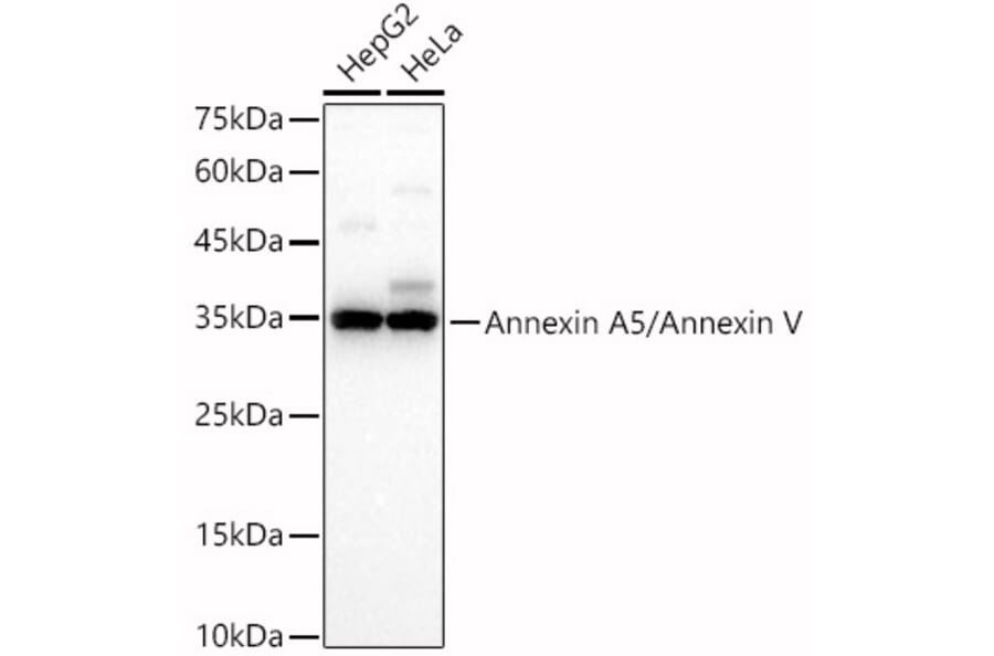 Western Blot - Anti-Annexin V/ANXA5 Antibody (A89471) - Antibodies.com