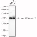 Western Blot - Anti-Annexin V/ANXA5 Antibody (A89471) - Antibodies.com