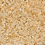 Immunohistochemistry - Anti-Annexin V/ANXA5 Antibody (A89471) - Antibodies.com