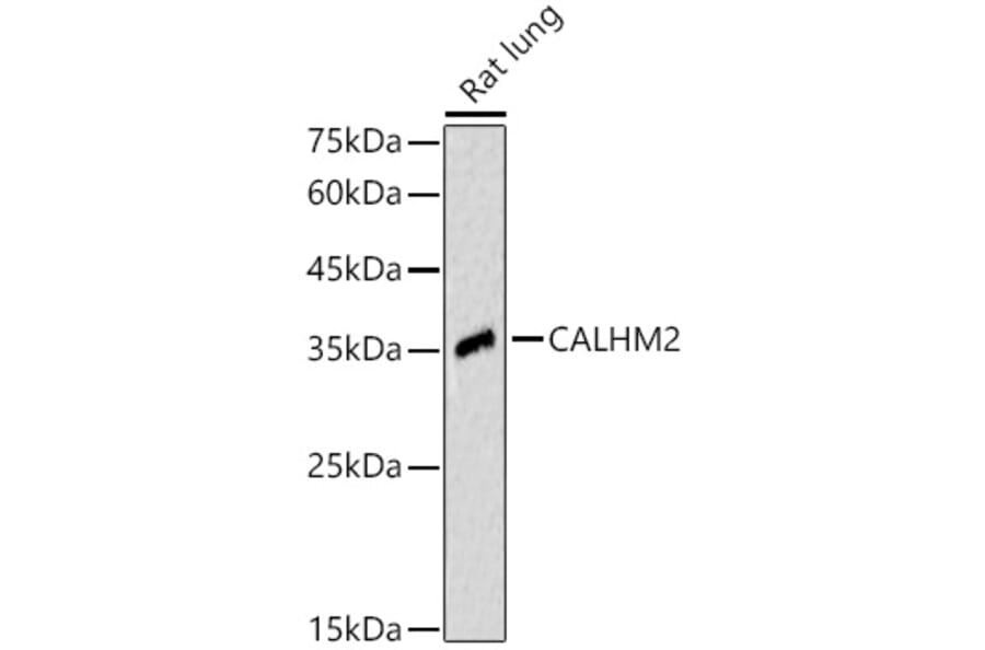 Western Blot - Anti-CALHM2 Antibody (A89472) - Antibodies.com