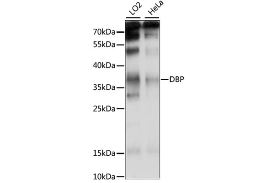 Western Blot - Anti-D Box Binding Protein Antibody (A89473) - Antibodies.com